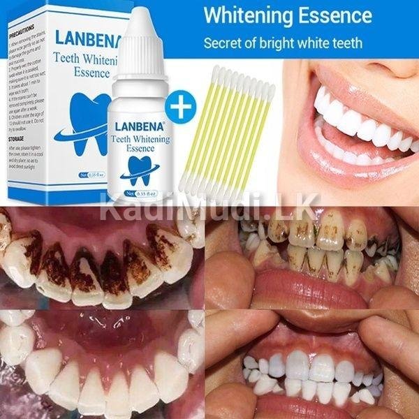 Teeth Whitening Kit – LANBENA